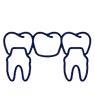 Dental crowns and bridges